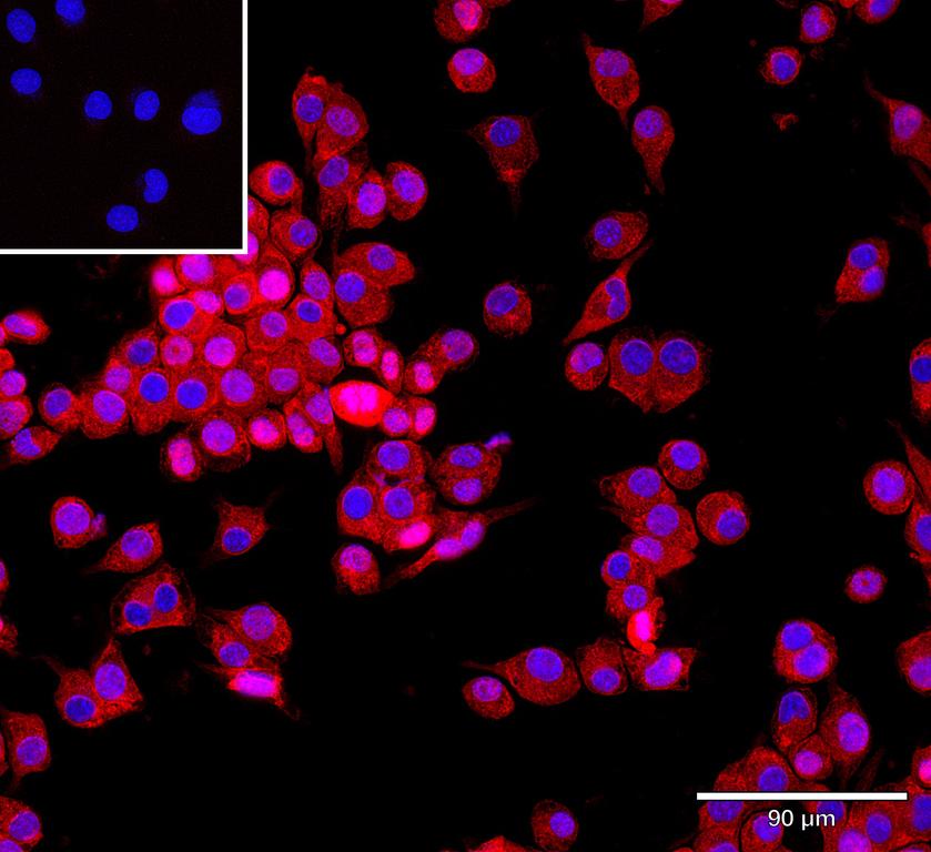 Ankyron MRC1_MOUSE Clone DK30102