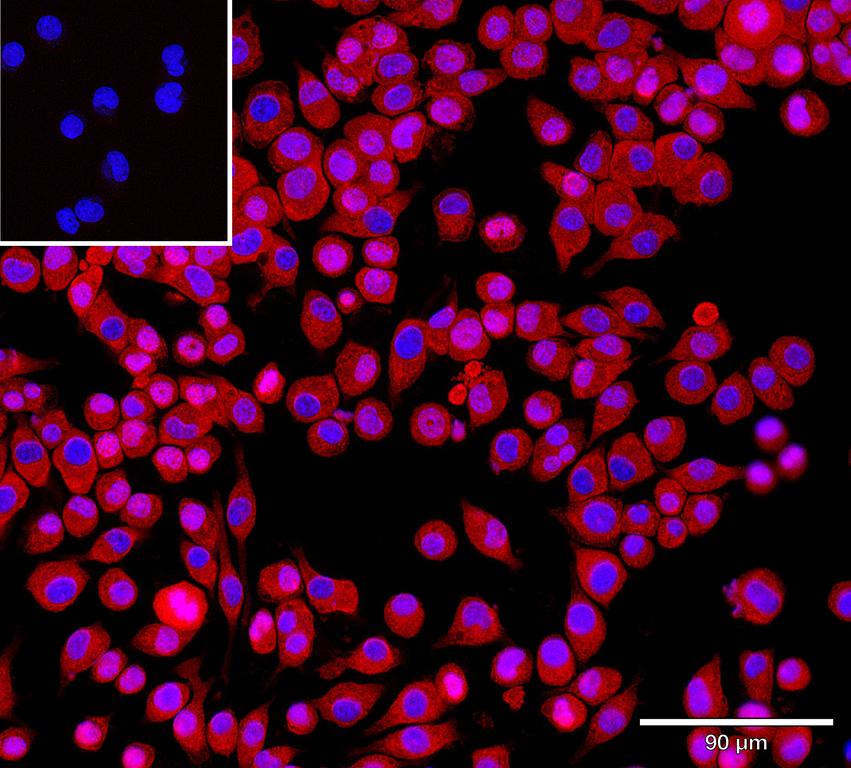 Ankyron MRC1_MOUSE Clone DK30103