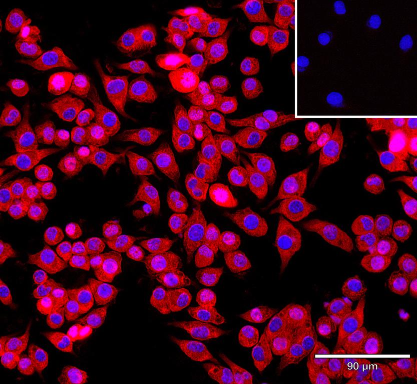 Ankyron MRC1_MOUSE Clone DK30104