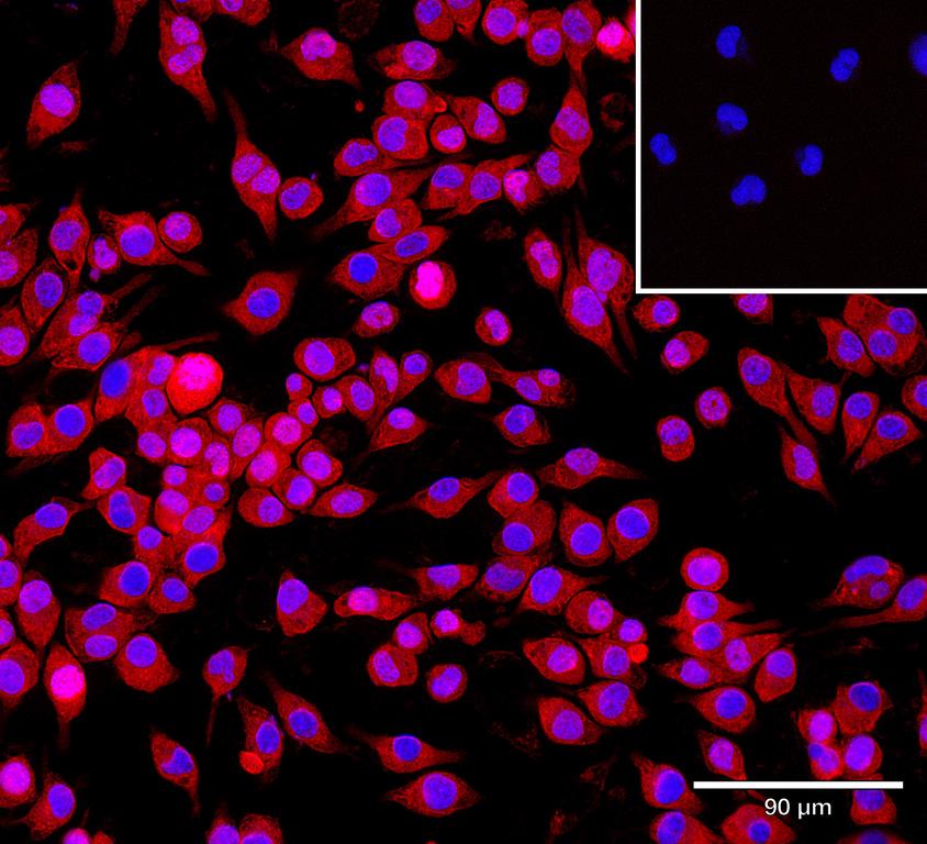 Ankyron MRC1_MOUSE Clone DK30105