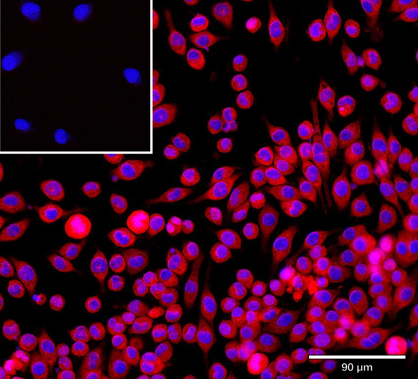 Ankyron MRC1_MOUSE Clone DK30108