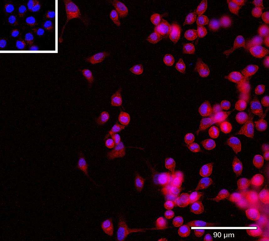 Ankyron MSLN_HUMAN Clone BN30141