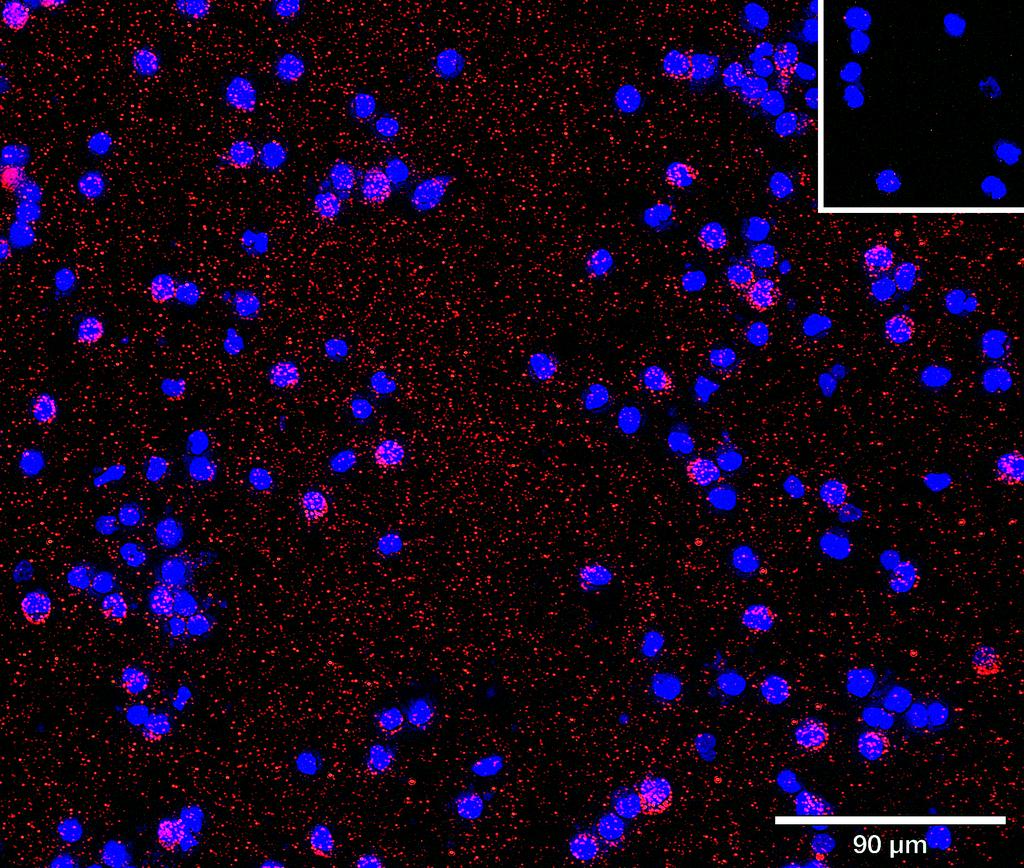 Ankyron MSRE_HUMAN Clone AH40162