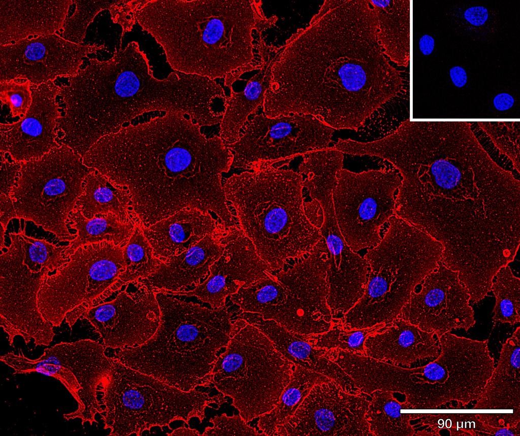 Ankyron MUC18_HUMAN Clone CC30474