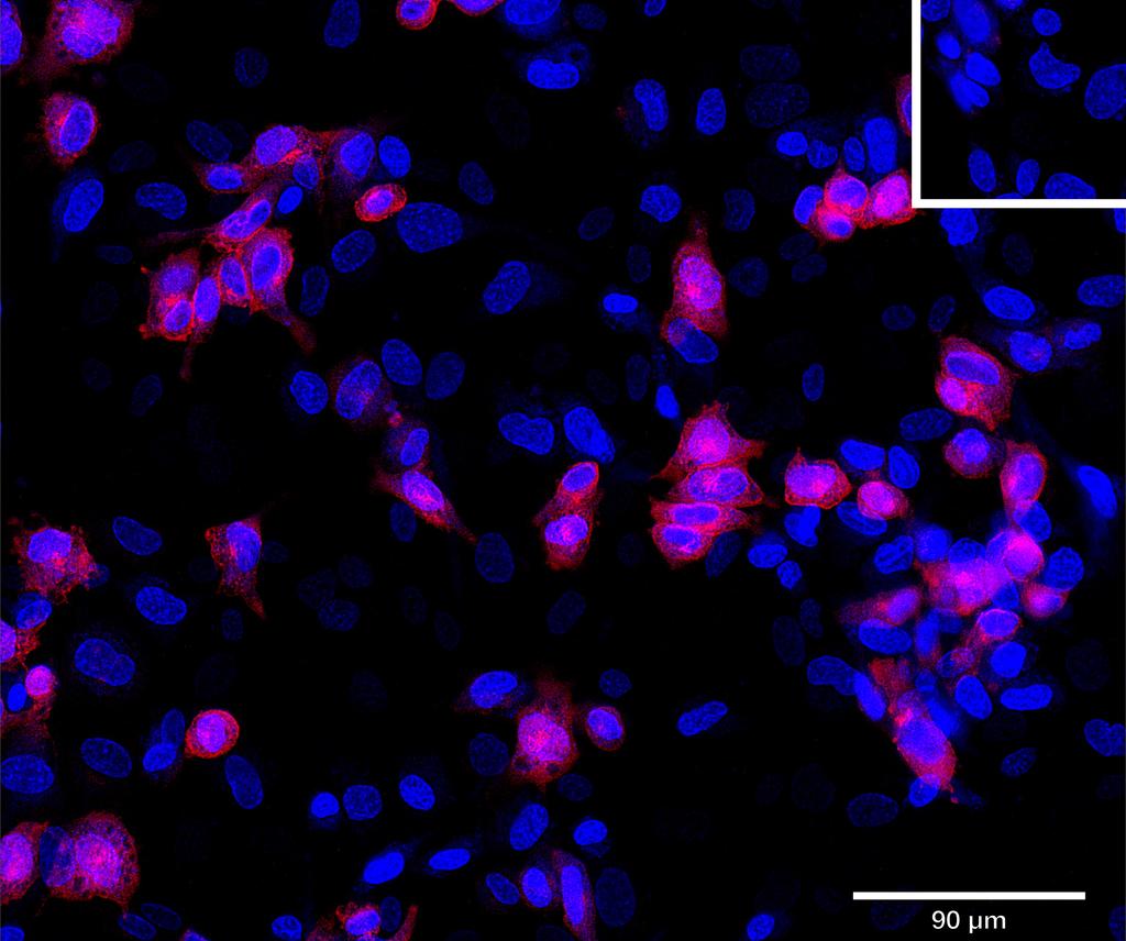 Ankyron MUC18_HUMAN Clone CJ30357