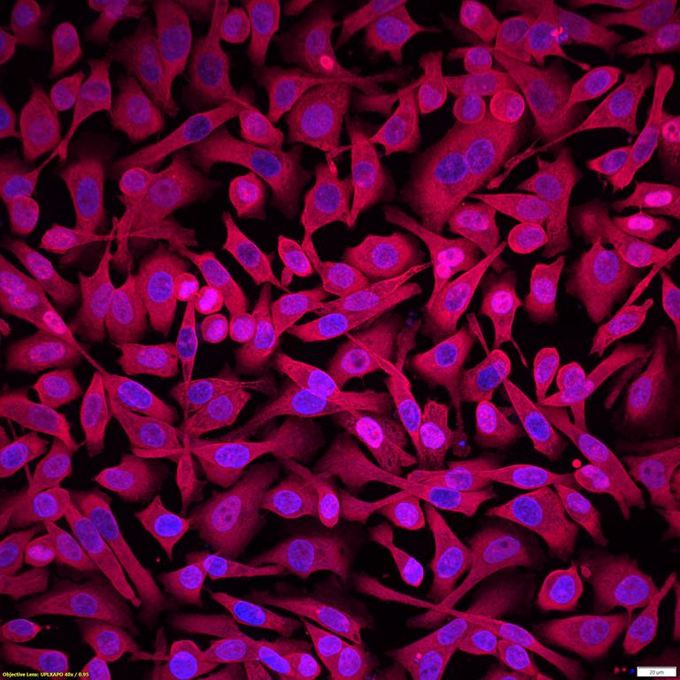 Ankyron MUC2_HUMAN Clone DV40225