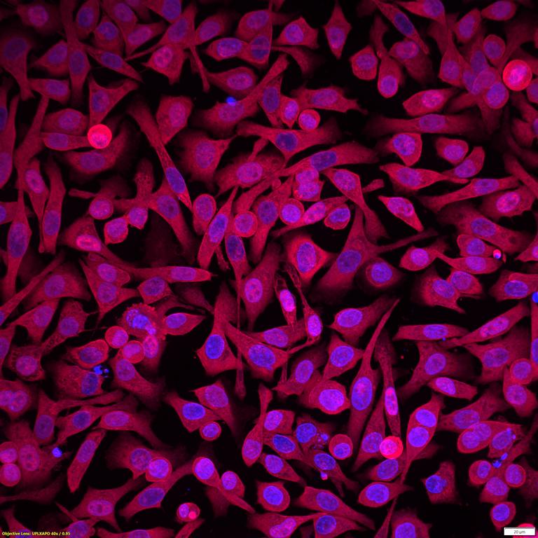 Ankyron MUC2_HUMAN Clone DV40222