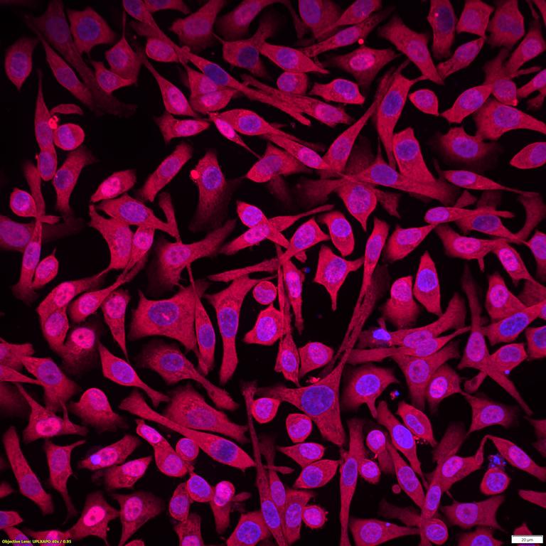 Ankyron MUC2_HUMAN Clone DV40223