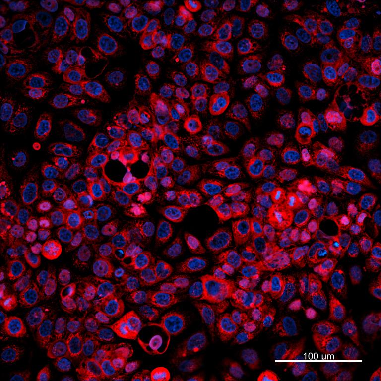 Ankyron MUCL1_HUMAN Clone DI40509
