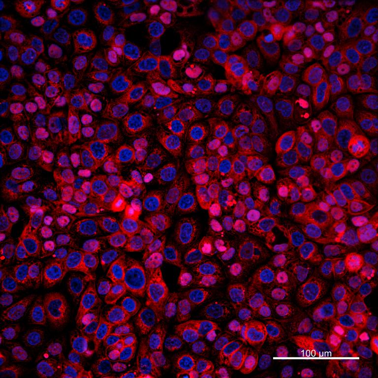 Ankyron MUCL1_HUMAN Clone DI40510