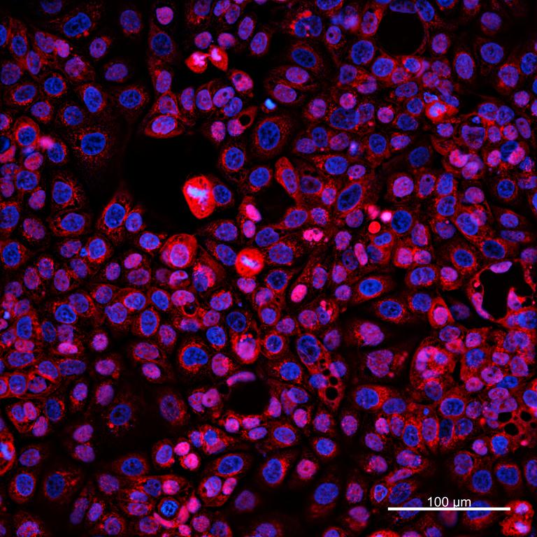 Ankyron MUCL1_HUMAN Clone DI40511