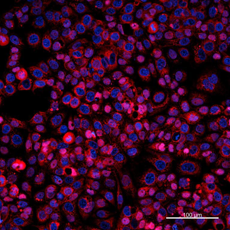 Ankyron MUCL1_HUMAN Clone DI40512