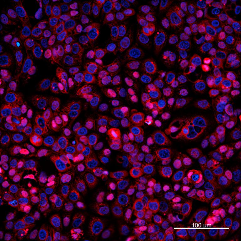 Ankyron MUCL1_HUMAN Clone DI40513