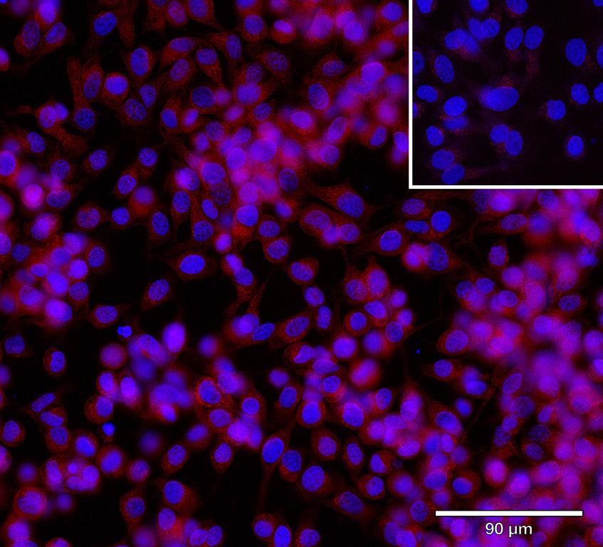Ankyron MYOC_HUMAN Clone CO40253