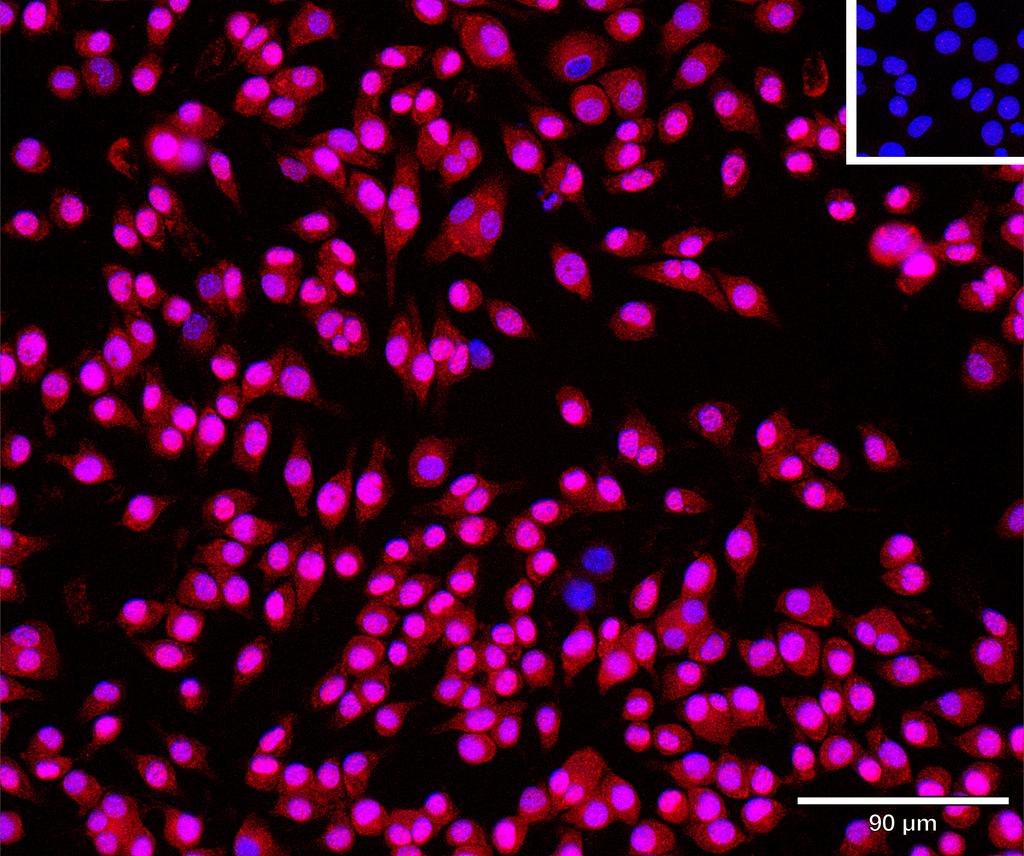 Ankyron NBL1_MOUSE Clone AO40313
