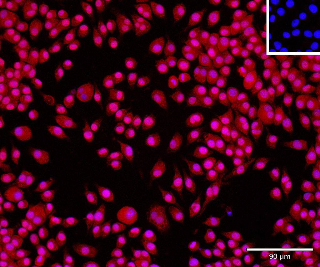 Ankyron NBL1_MOUSE Clone AO40322