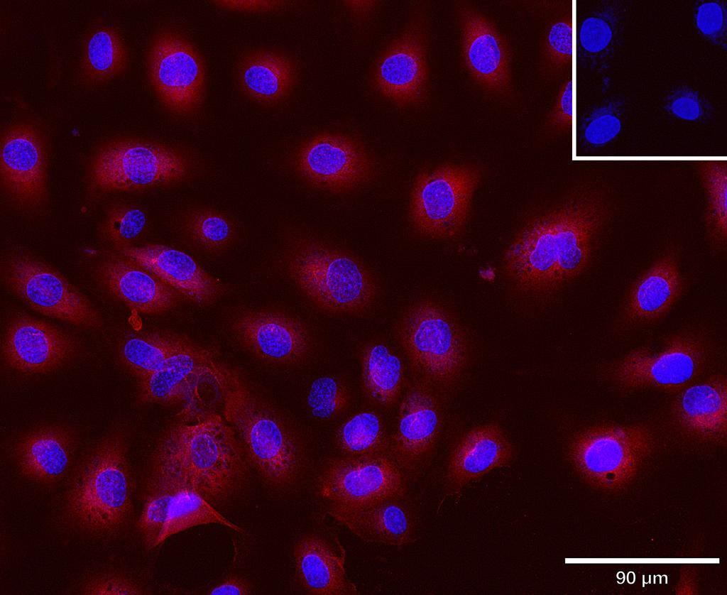 Ankyron NCAM1_HUMAN Clone BJ40513
