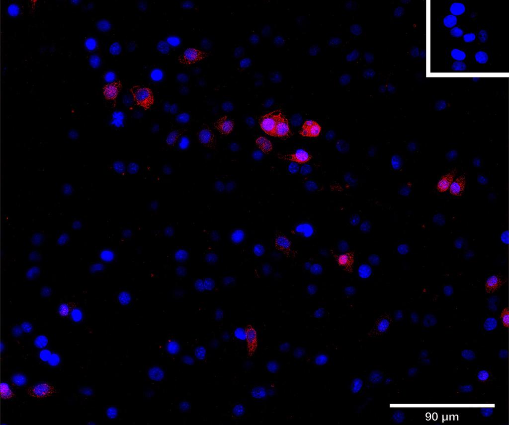 Ankyron NCAM1_MOUSE Clone BP40214