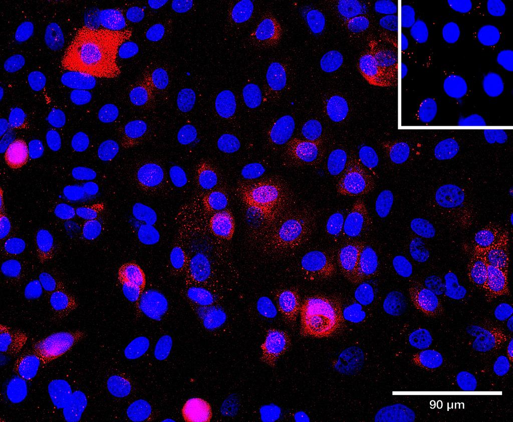 Ankyron NCAM2_HUMAN Clone CD30210