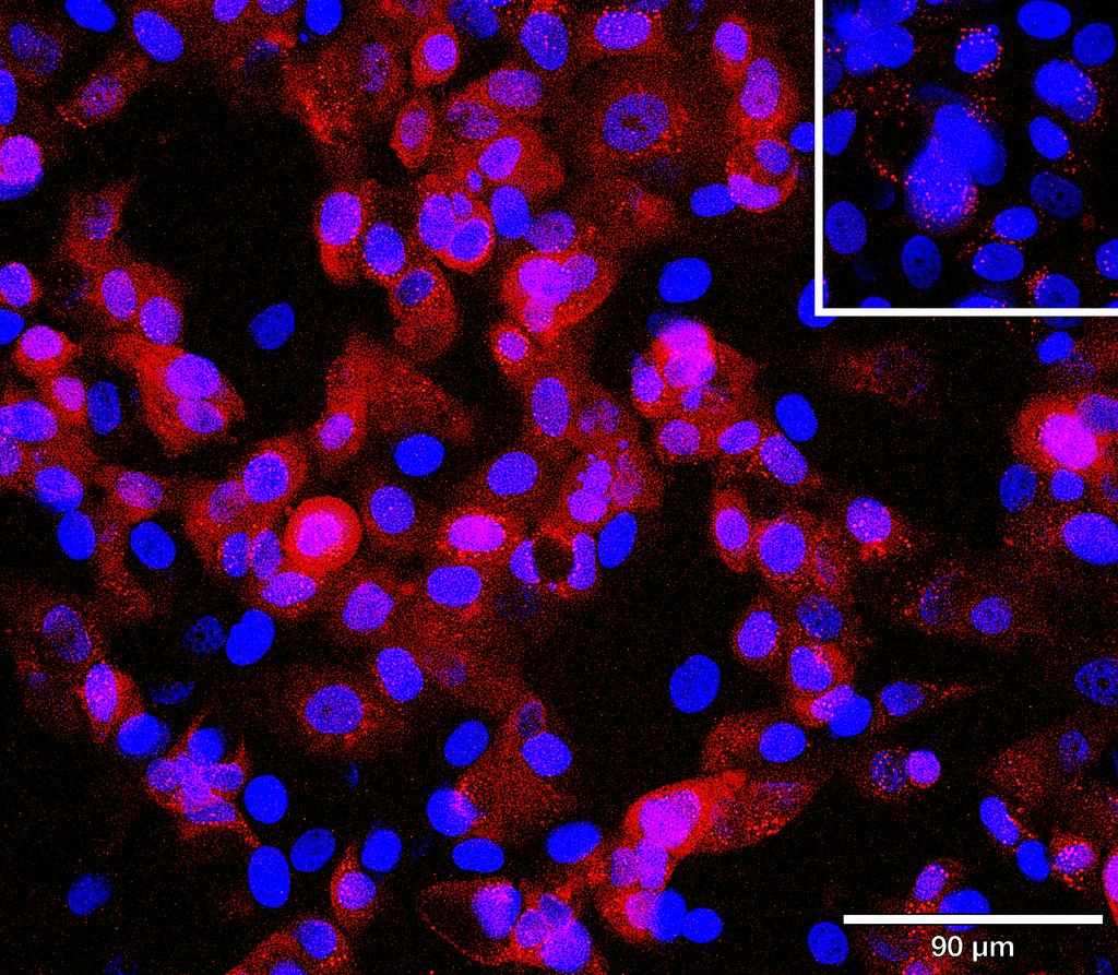 Ankyron NCAM2_HUMAN Clone BJ40170
