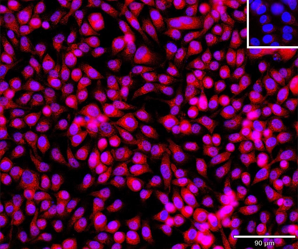 Ankyron NET1_HUMAN Clone BV40761