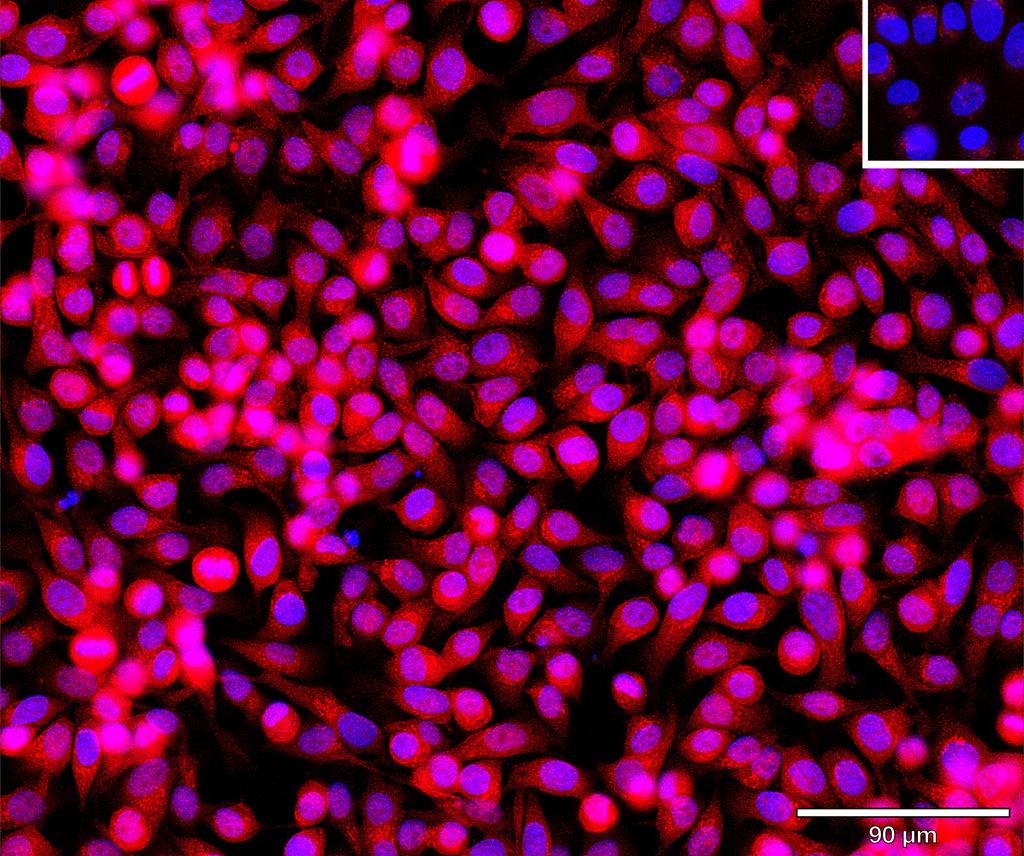 Ankyron NET1_HUMAN Clone BV40763