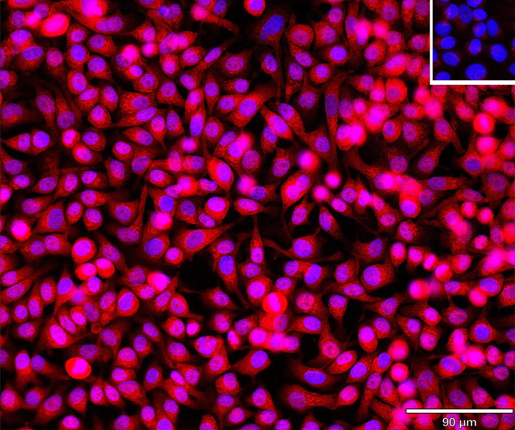 Ankyron NET1_HUMAN Clone BV40764