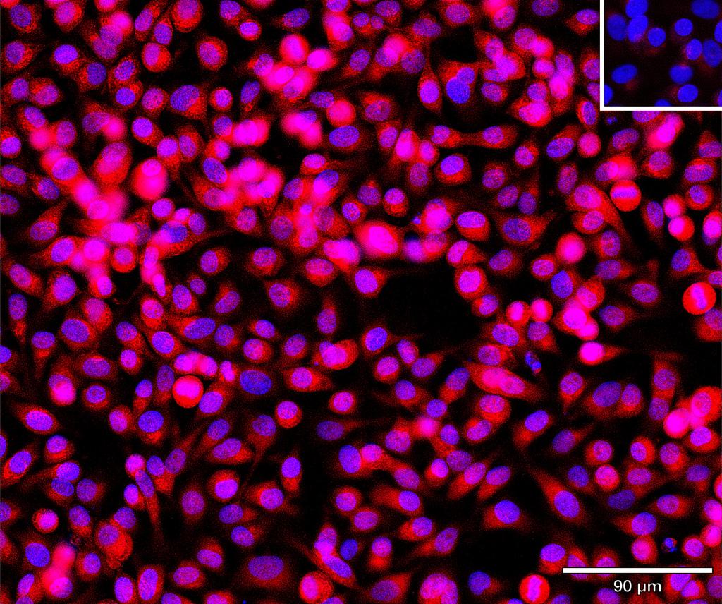 Ankyron NET1_HUMAN Clone BV40766