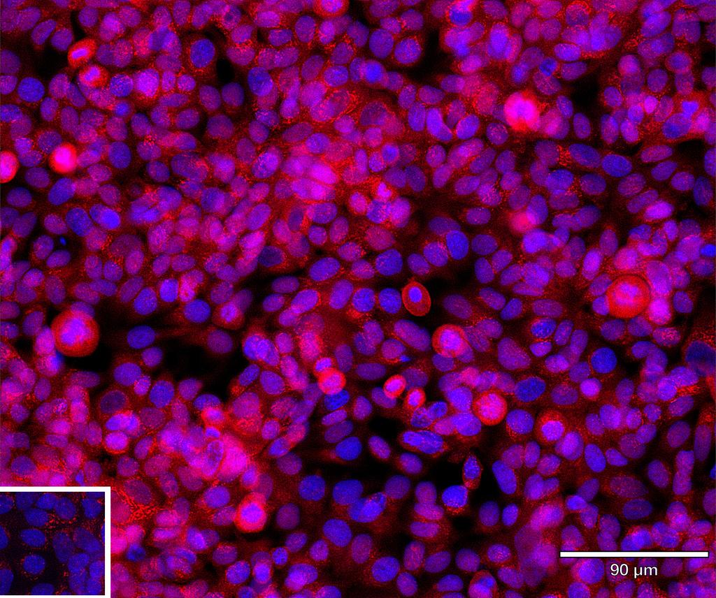 Ankyron NFAC1_HUMAN Clone BZ30864