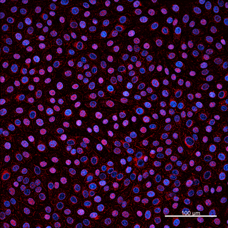 Ankyron NHRF1_BOVIN Clone FY40193