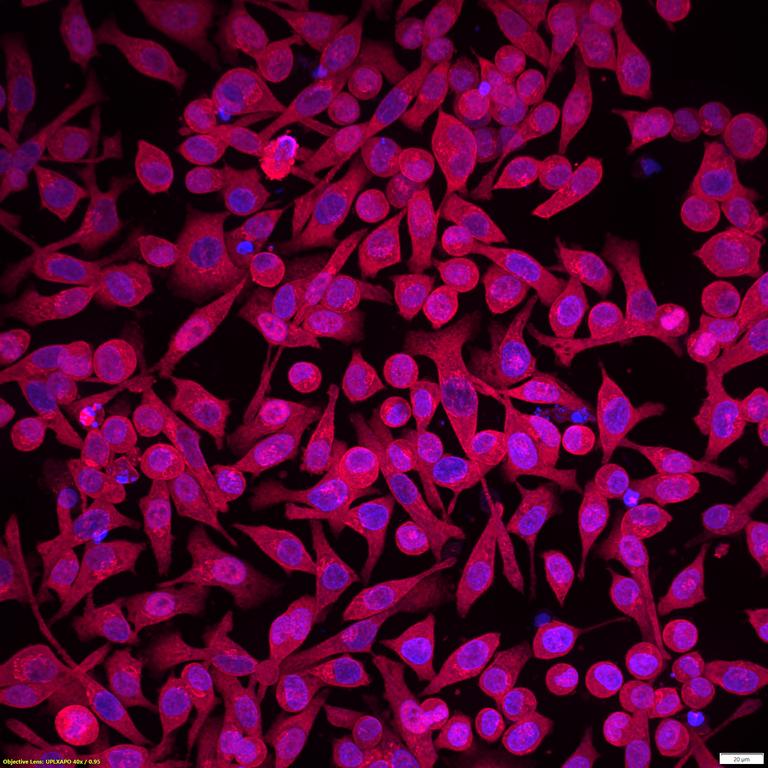 Ankyron NOS1_HUMAN Clone EK30640