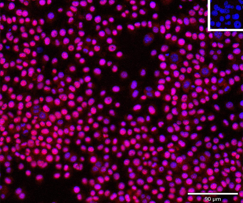 Ankyron NRP2_MOUSE Clone CG30257