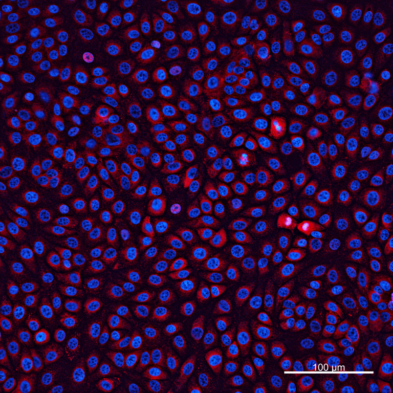Ankyron NRX3B_BOVIN Clone FC40583
