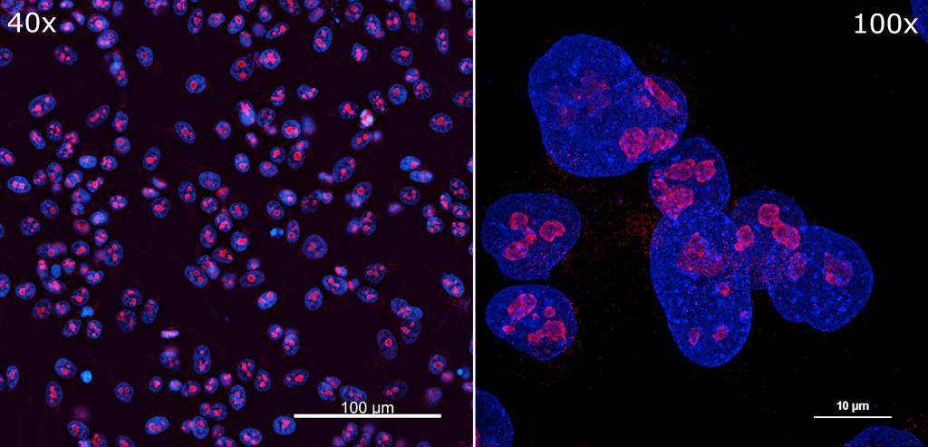Ankyron NUCL_HUMAN Clone FN40366