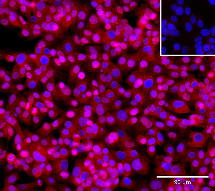 Ankyron ODO2_HUMAN Clone AR40539