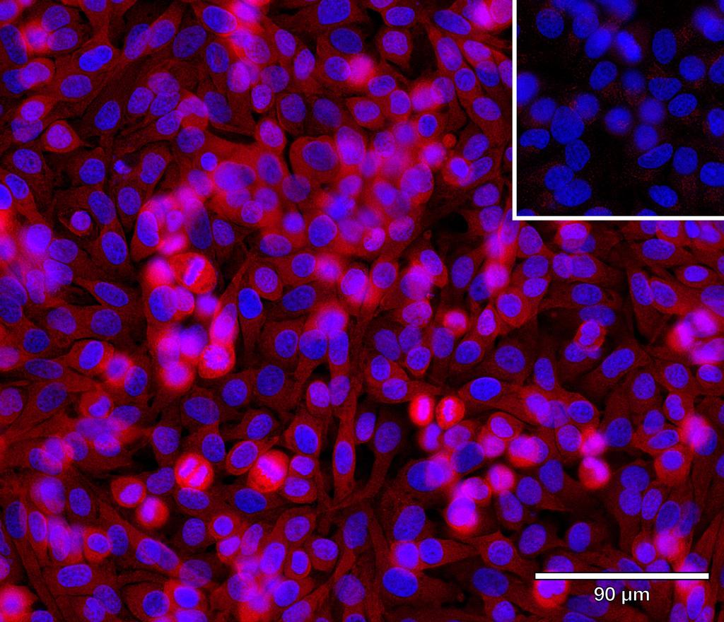 Ankyron ODO2_HUMAN Clone AR40535