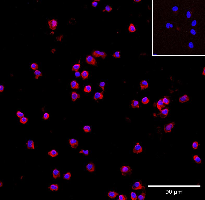 Ankyron ONCM_HUMAN Clone CD30489