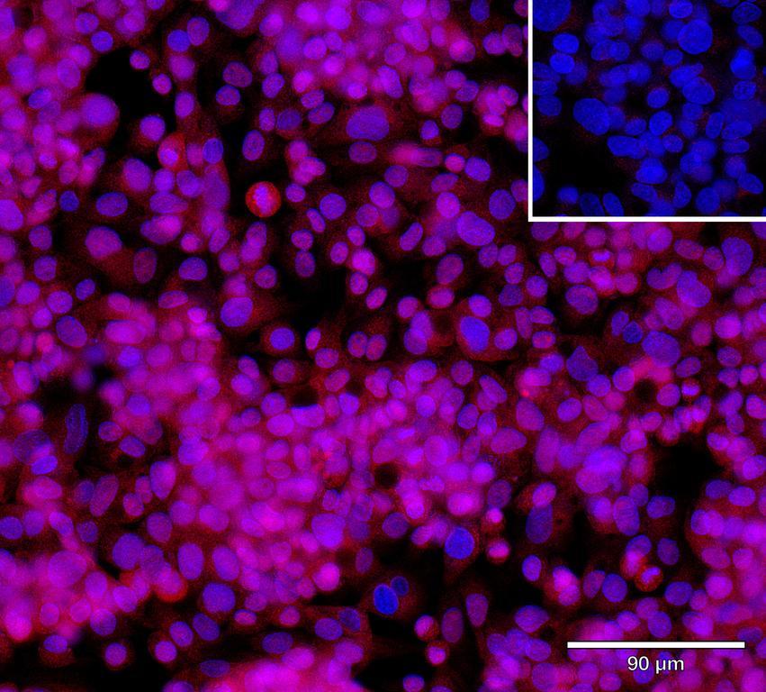 Ankyron OSTM1_HUMAN Clone AR40255