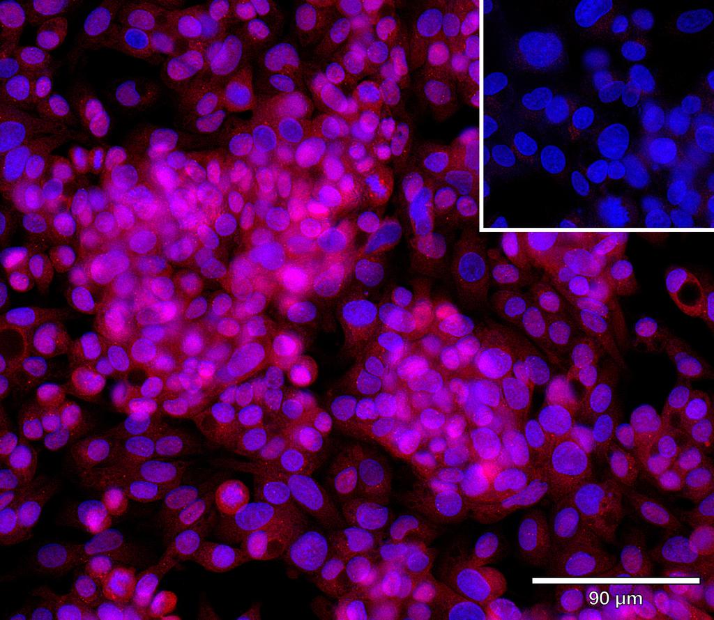 Ankyron OSTM1_HUMAN Clone AR40256