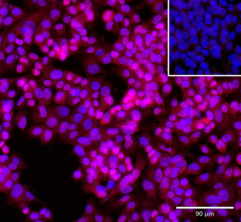 Ankyron OSTM1_HUMAN Clone AR40261