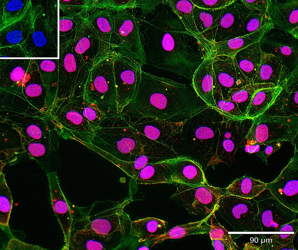 Ankyron PCNA_HUMAN Clone BV40161