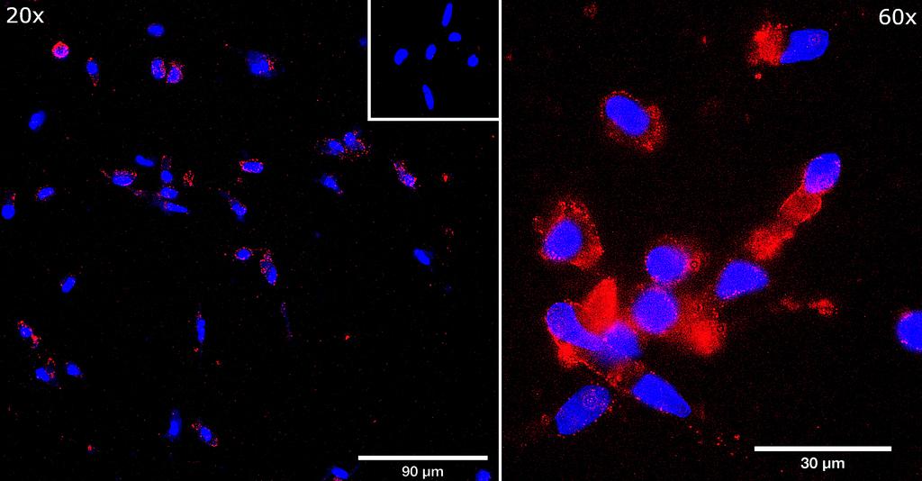 Ankyron PD1L1_HUMAN Clone BS40922