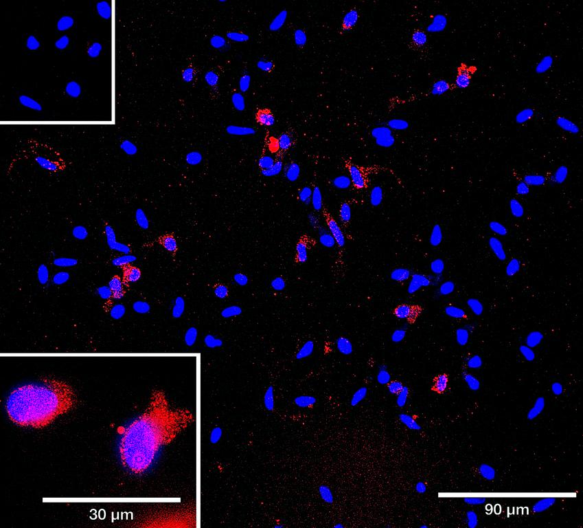Ankyron PD1L2_HUMAN Clone AB30221