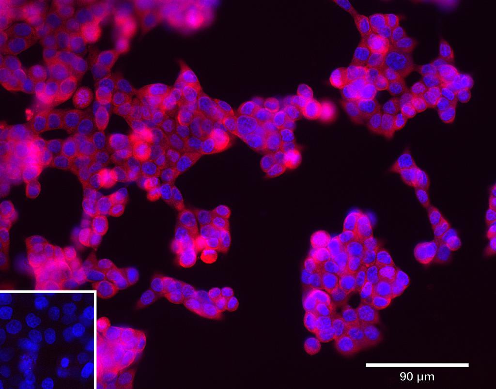 Ankyron PDCD1_HUMAN Clone BJ40510