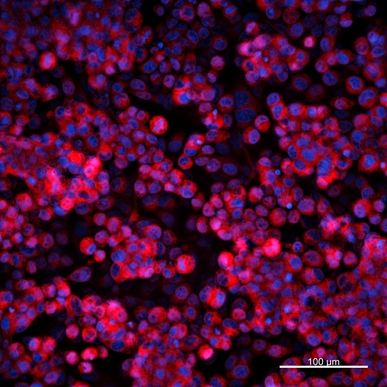 Ankyron PDGFA_HUMAN Clone FI40341