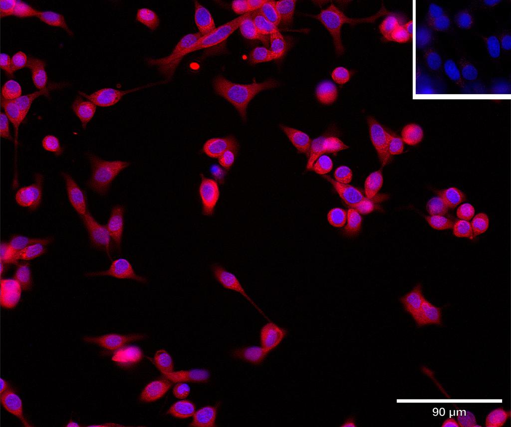 Ankyron PDK1_HUMAN Clone CD30221