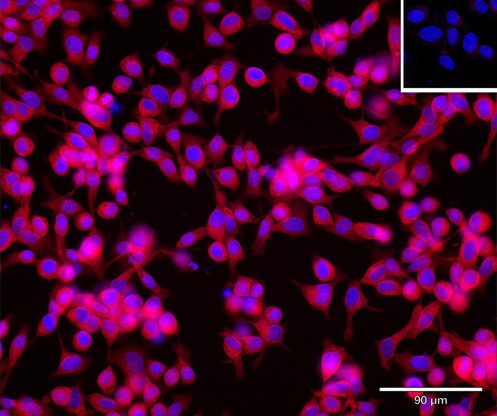 Ankyron PDK1_HUMAN Clone CD30228