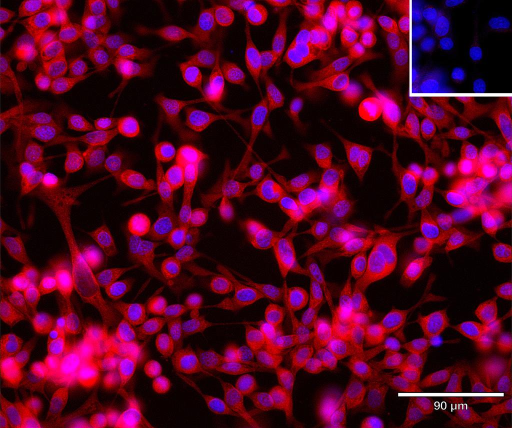 Ankyron PDK1_HUMAN Clone CD30229