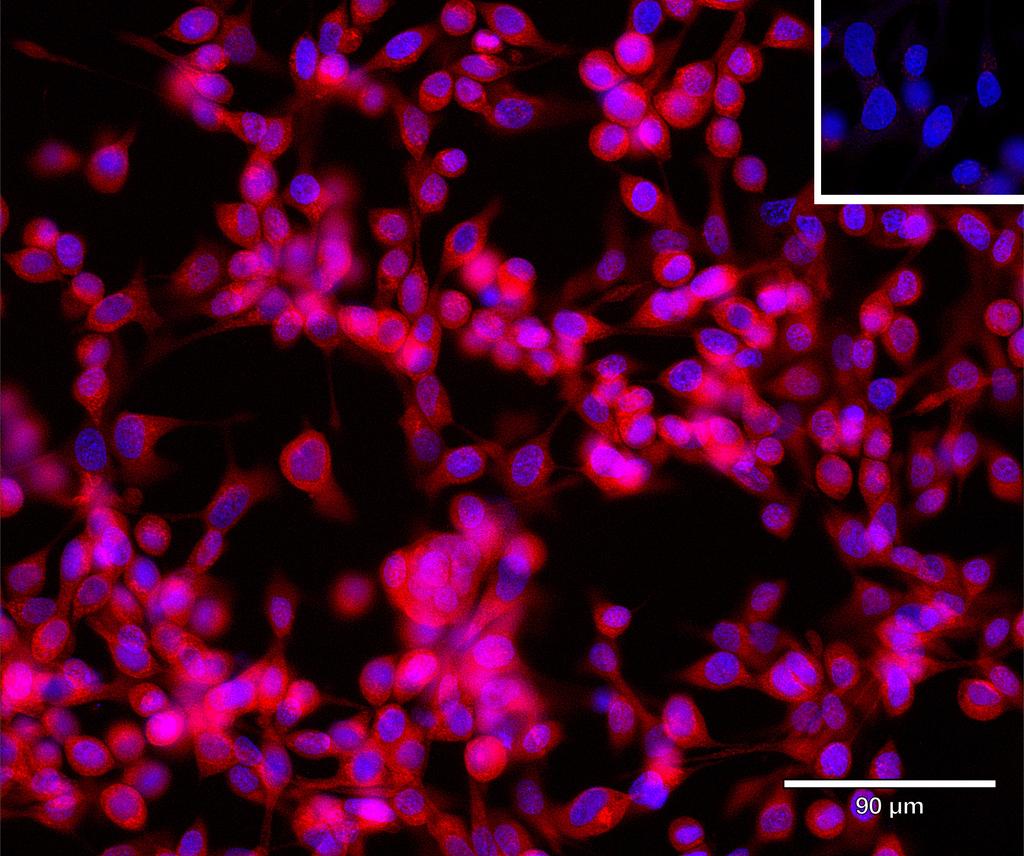 Ankyron PDK1_HUMAN Clone CD30232
