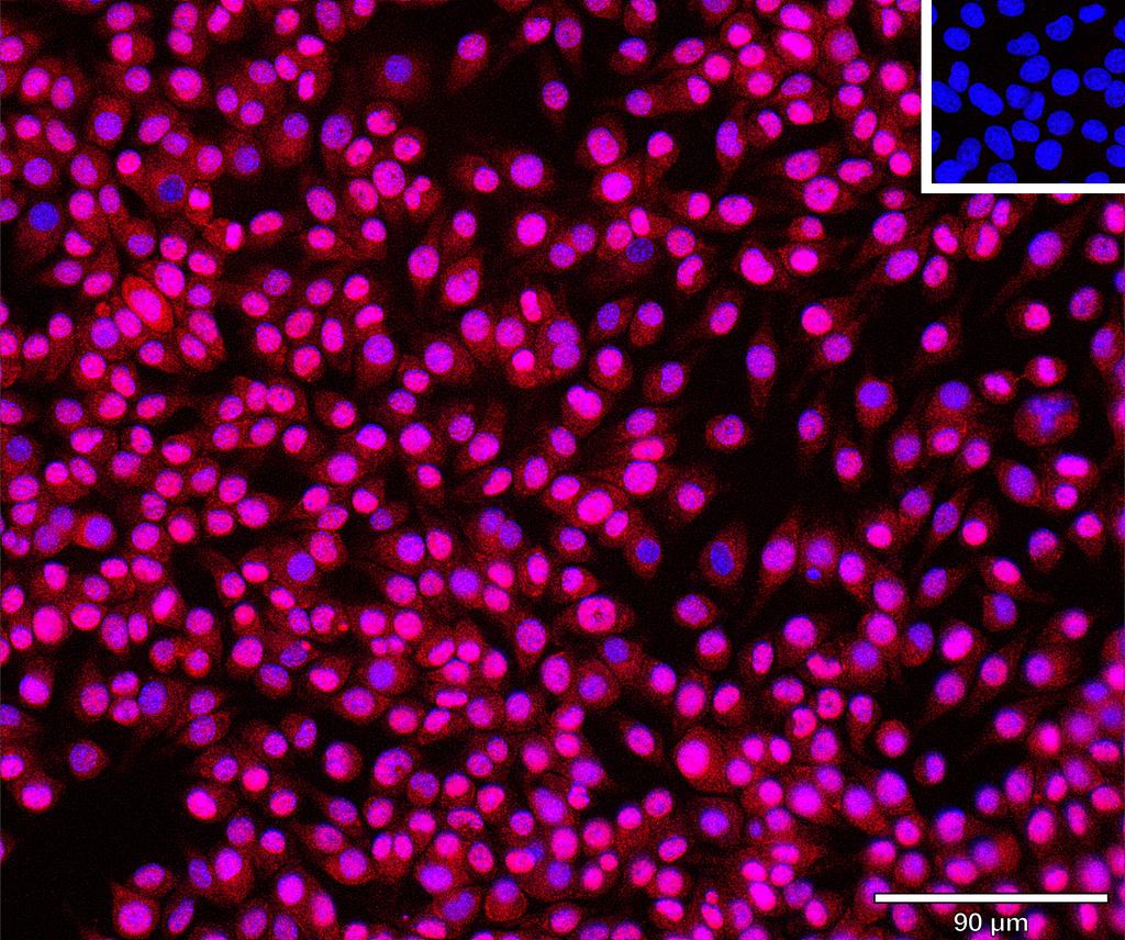 Ankyron PGBM_MOUSE Clone BP40147